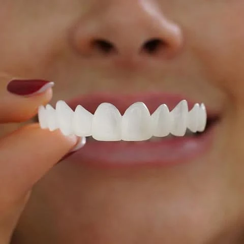 Zähne Veneers Kunststoff für perfektes Lächeln